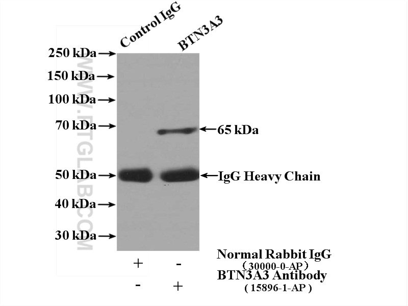 IP experiment of Jurkat using 15896-1-AP