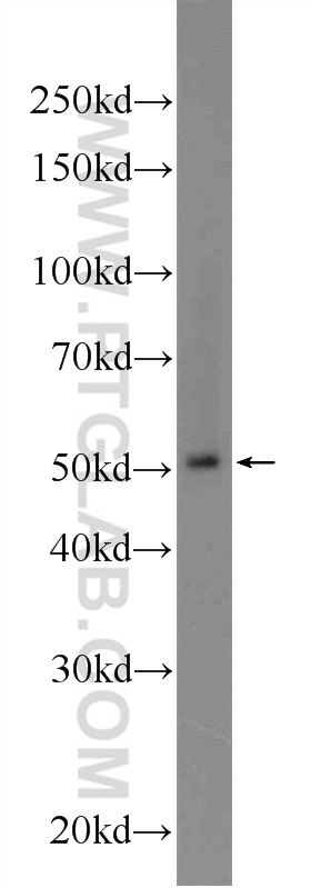 WB analysis of MCF-7 using 24959-1-AP