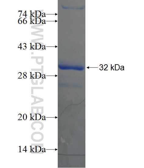 BTNL8 fusion protein Ag21203 SDS-PAGE