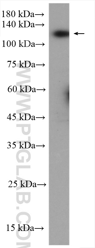 WB analysis of MKN-45 using 13330-1-AP