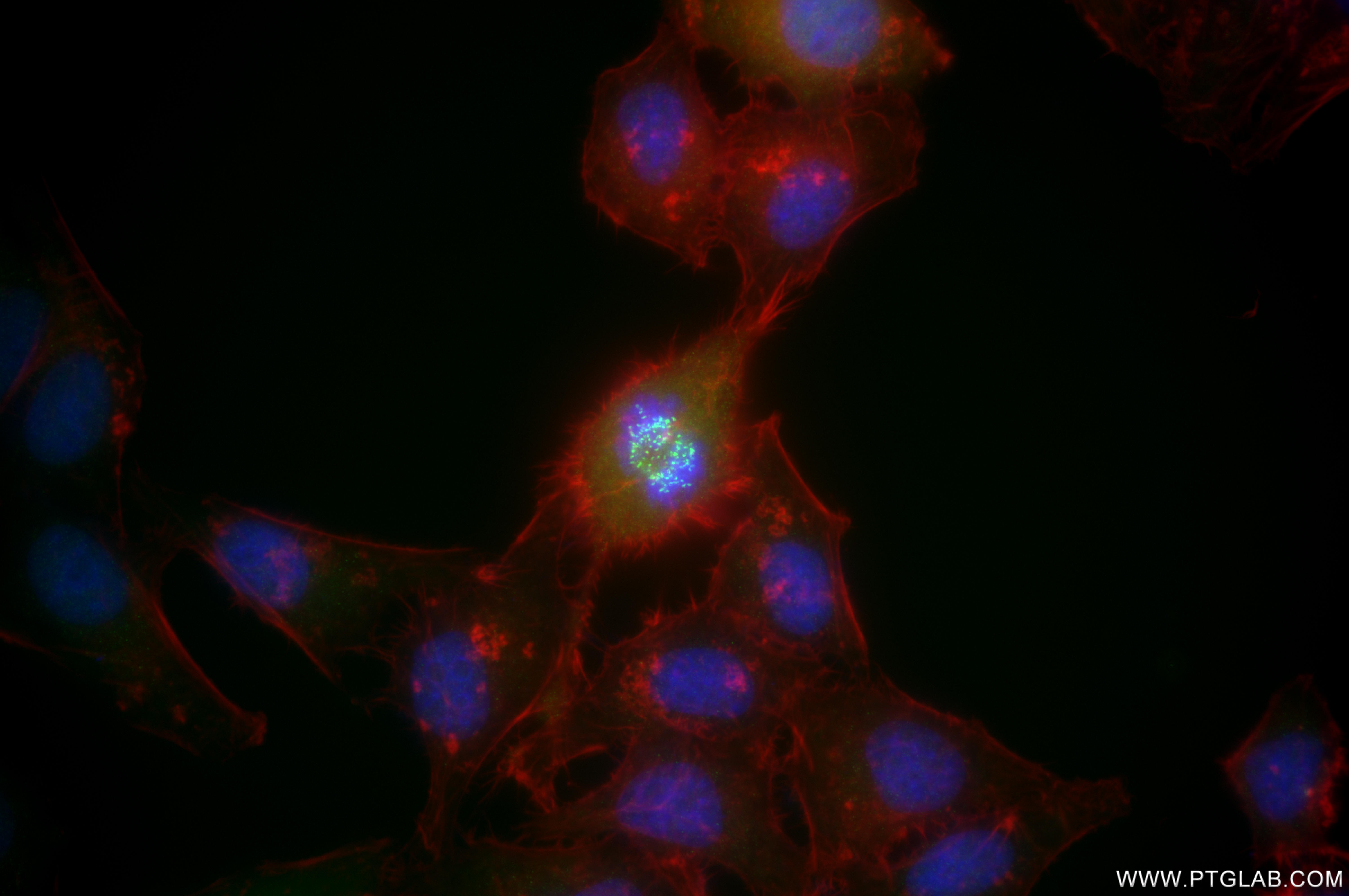 IF Staining of HepG2 using 86843-4-RR IF Staining of HepG2 using 86843-4-RR