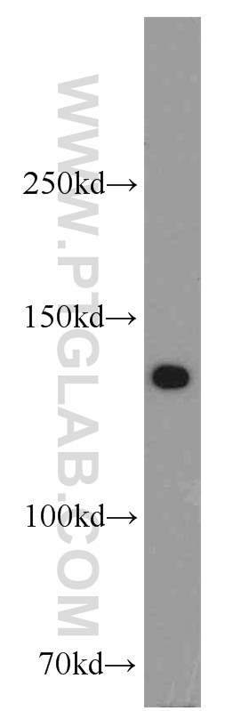 WB analysis of mouse testis using 11504-2-AP