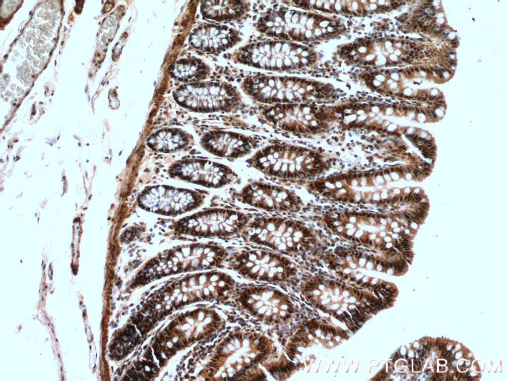 IHC staining of human colon using 27073-1-AP