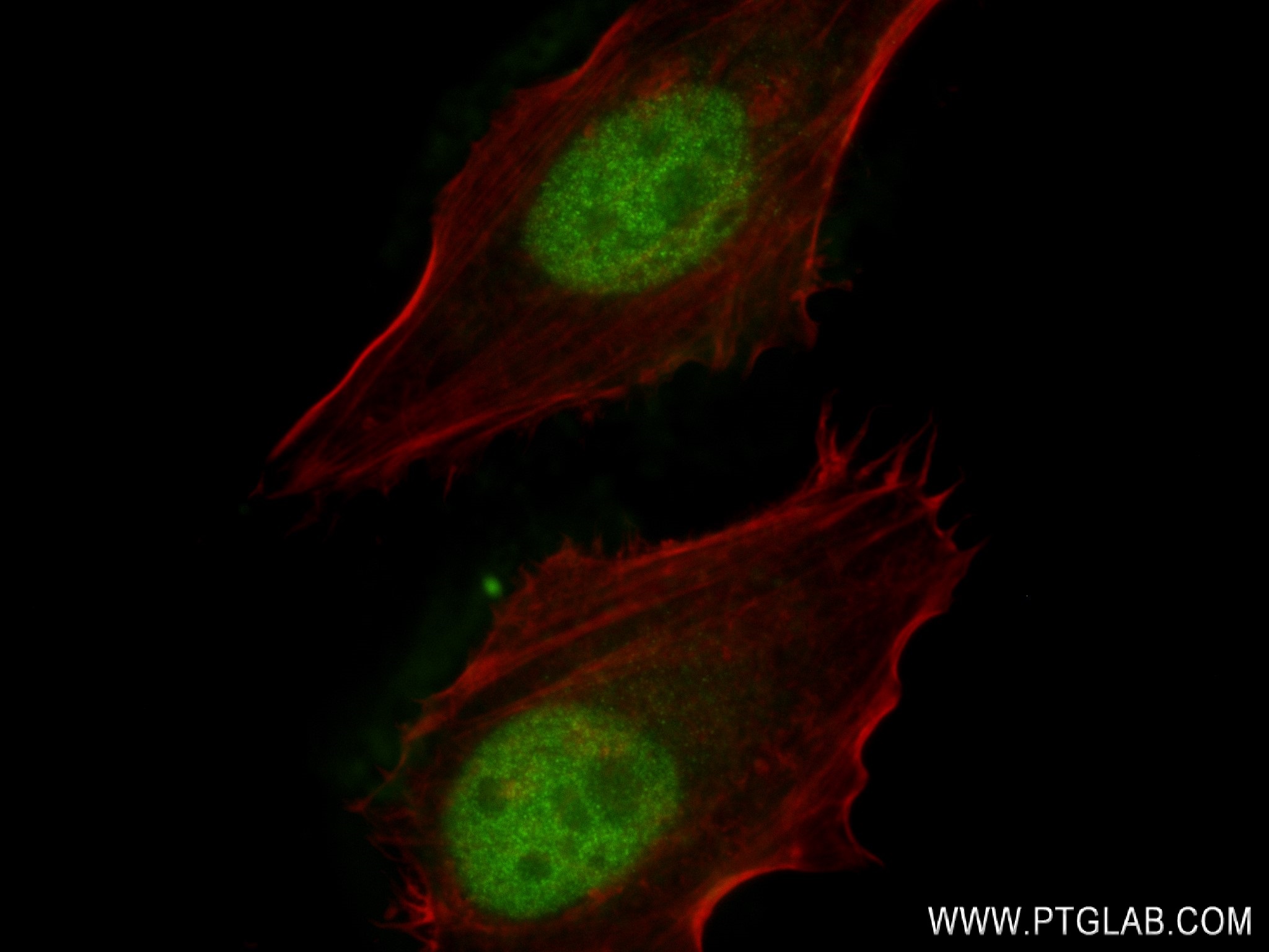 IF Staining of HeLa using 83266-5-RR (same clone as 83266-5-PBS)