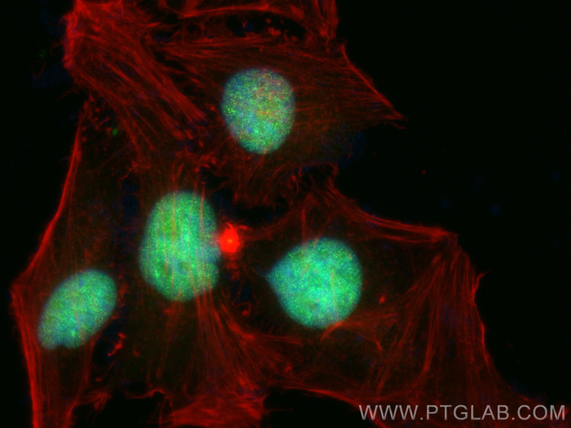 IF Staining of HeLa using 83266-5-RR (same clone as 83266-5-PBS)