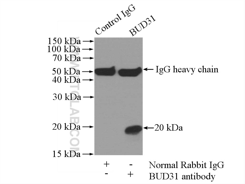 IP experiment of mouse brain using 11798-1-AP