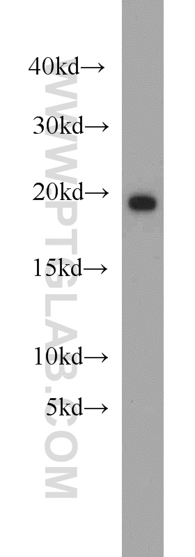 WB analysis of mouse brain using 11798-1-AP