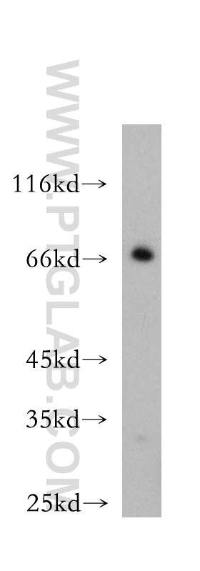 WB analysis of mouse skeletal muscle using 12920-1-AP