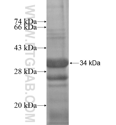 BVES fusion protein Ag14601 SDS-PAGE BVES fusion protein Ag14601 SDS-PAGE