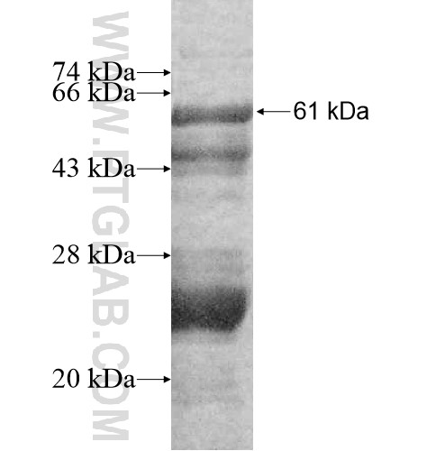 BXDC1 fusion protein Ag11522 SDS-PAGE BXDC1 fusion protein Ag11522 SDS-PAGE