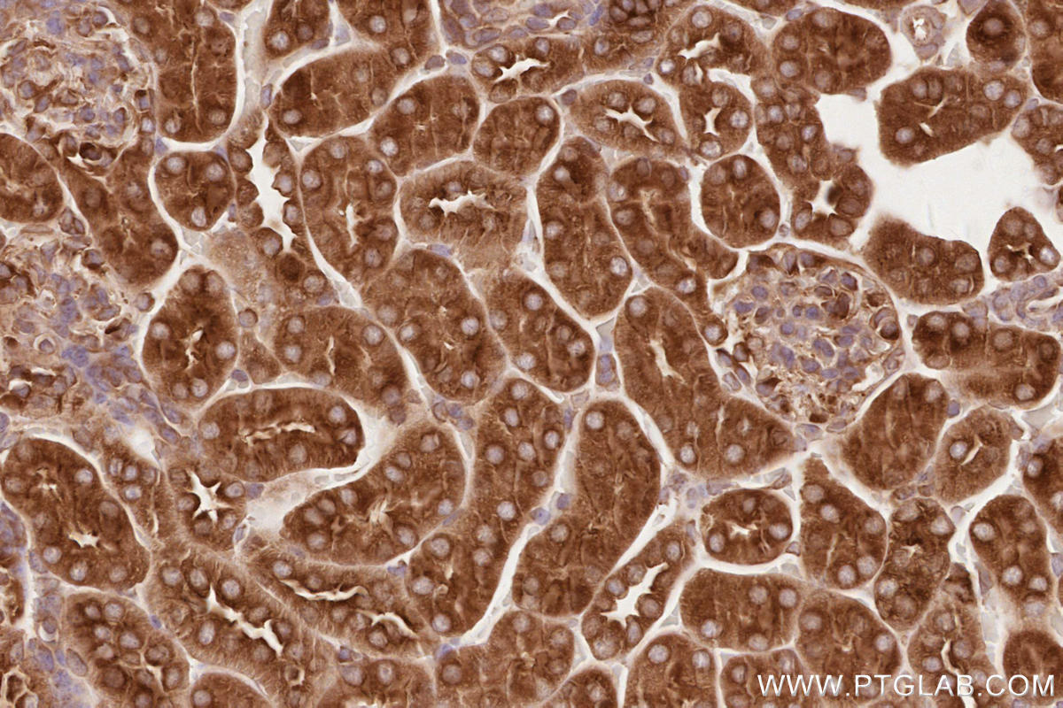IHC staining of mouse kidney using 19917-1-AP