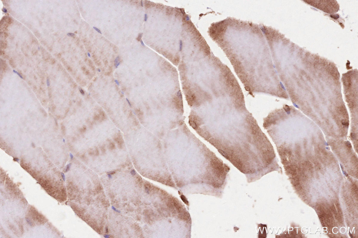 IHC staining of mouse skeletal muscle using 19917-1-AP