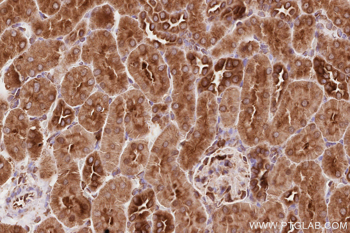 IHC staining of rat kidney using 19917-1-AP