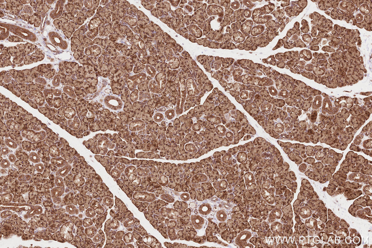 IHC staining of rat salivary gland using 19917-1-AP