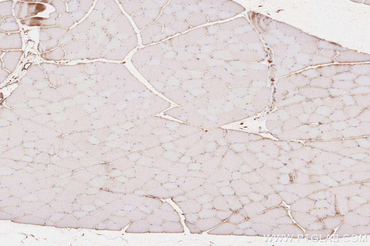 IHC staining of rat skeletal muscle using 19917-1-AP