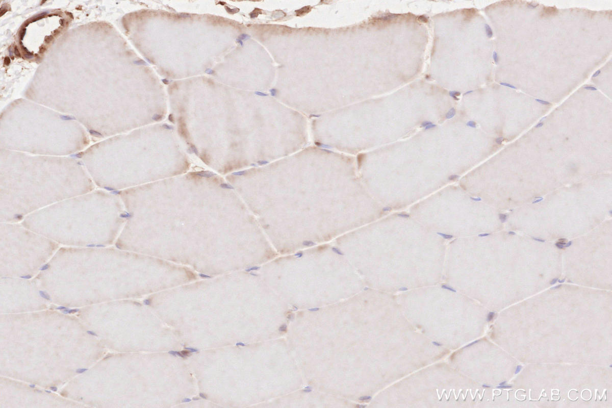 IHC staining of rat skeletal muscle using 19917-1-AP