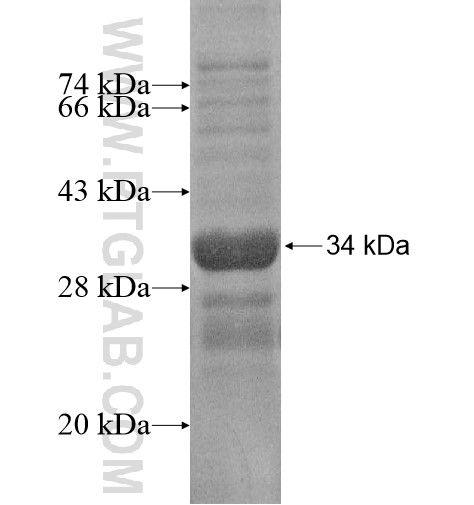 BZW2 fusion protein Ag15126 SDS-PAGE
