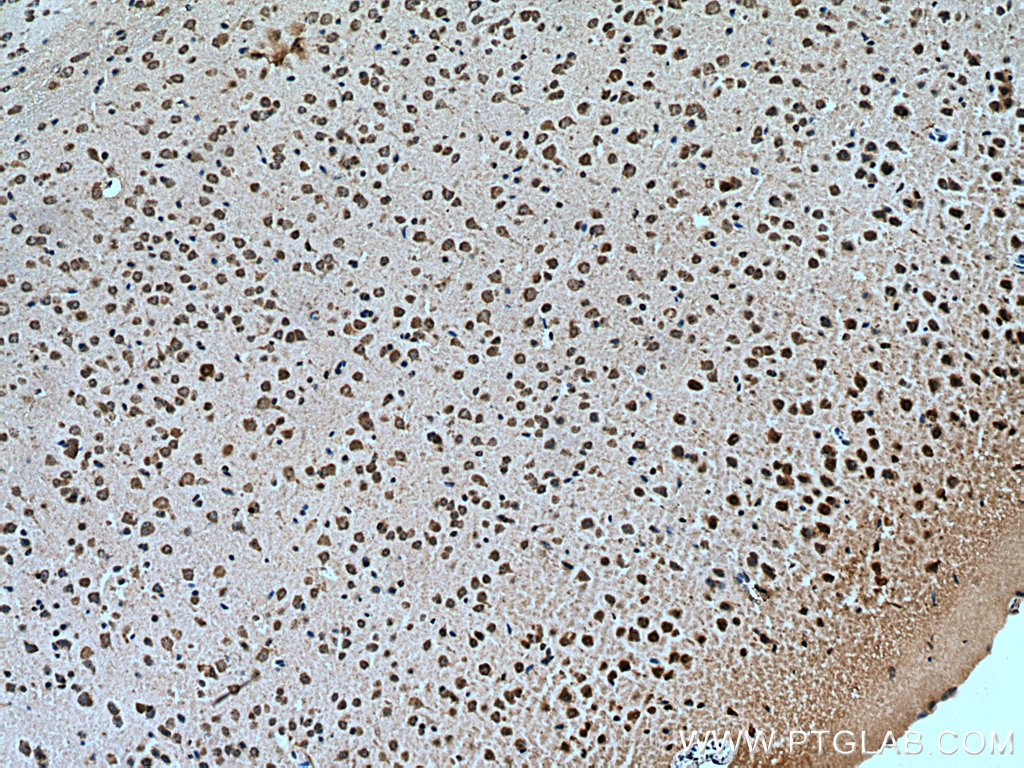 IHC staining of mouse brain using 19491-1-AP