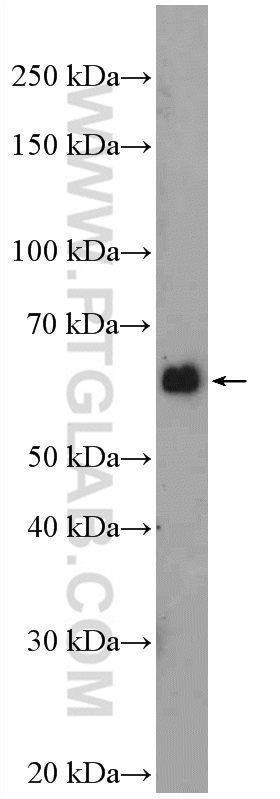 WB analysis of HEK-293 using 19491-1-AP