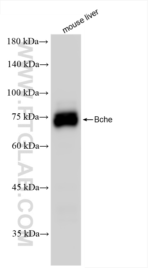 WB analysis of mouse liver using 85722-4-RR (same clone as 85722-4-PBS)