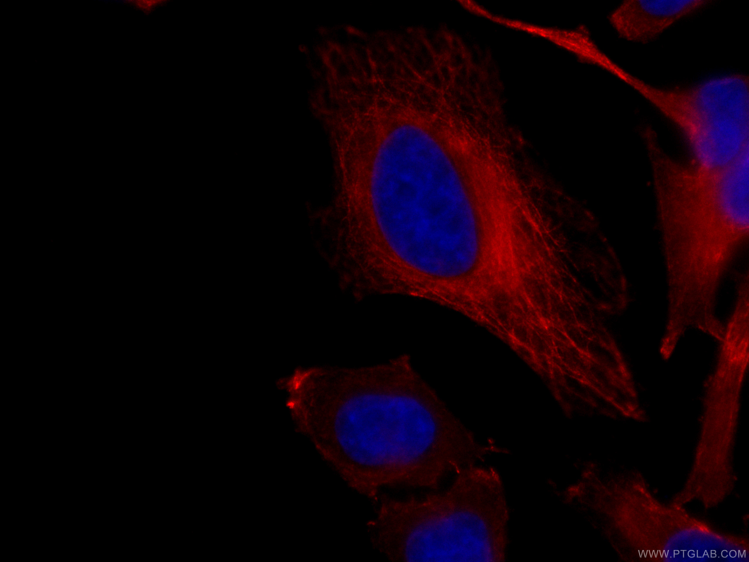 IF Staining of HeLa using CL594-66020