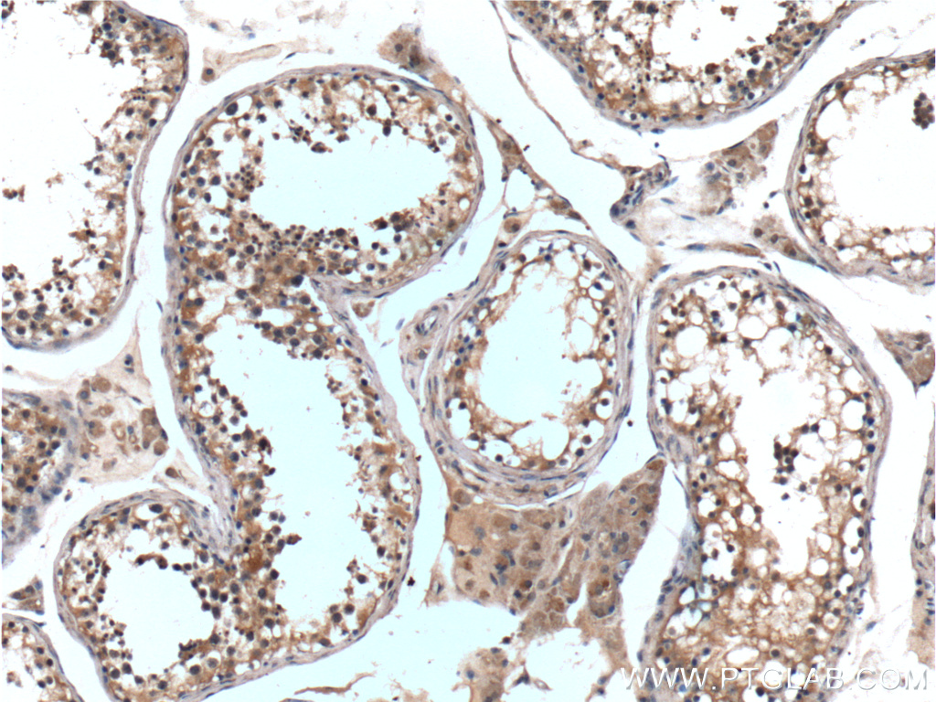 IHC staining of human testis using 26967-1-AP