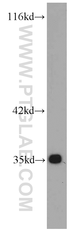 Bcl-XL Monoclonal antibody