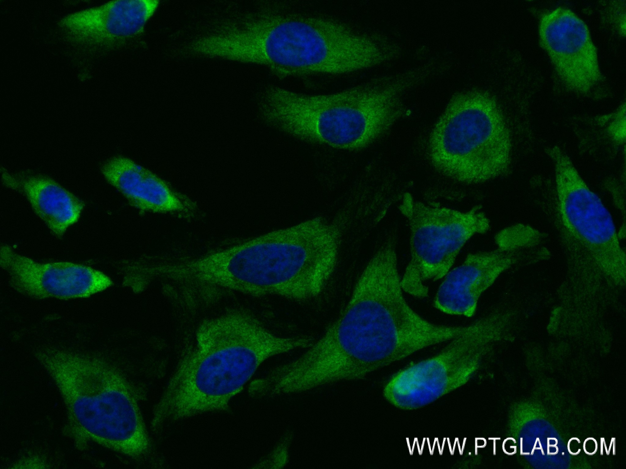 IF Staining of HeLa using 83330-2-RR