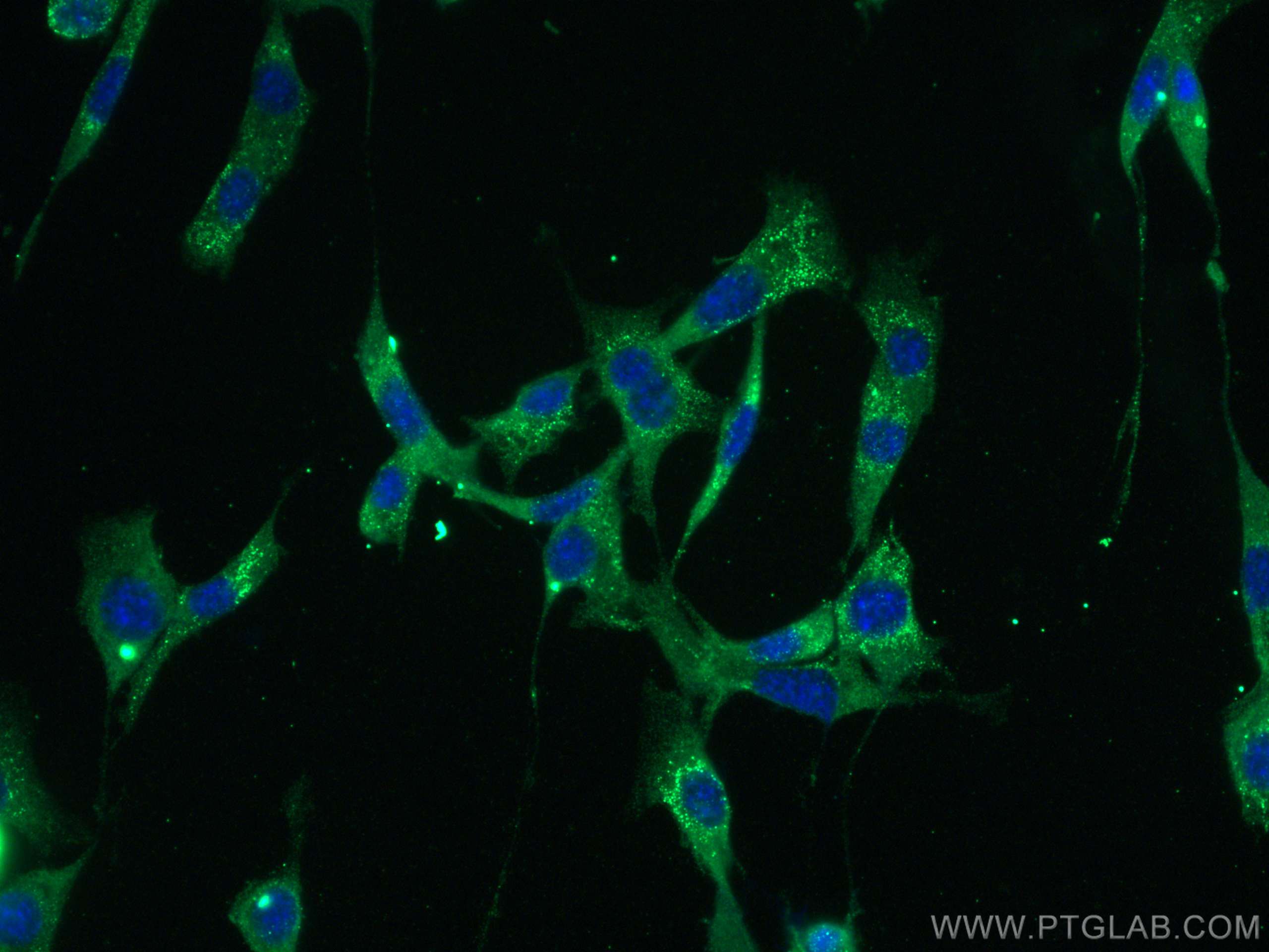 IF Staining of NIH/3T3 using 68103-1-Ig (same clone as 68103-1-PBS)