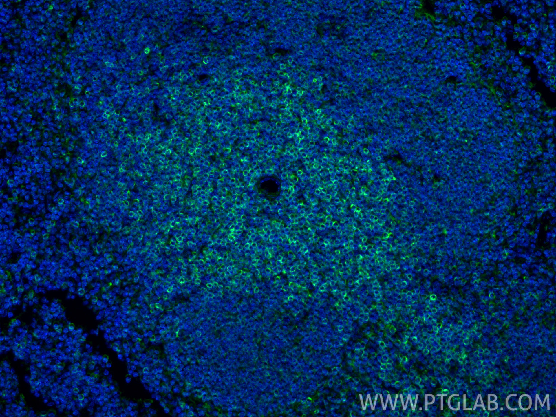 Immunofluorescent analysis of (4% PFA) fixed paraffin-embedded mouse spleen tissue using Bcl2 antibody (82469-6-RR, Clone: 240571H5 ) at dilution of 1:1000 and CoraLite®488-Conjugated Goat Anti-Rabbit IgG(H+L) (<a class='green' href='/productredirect?CatalogNo=SA00013-2' target='_blank'>SA00013-2</a>). Heat mediated antigen retrieval with Tris-EDTA buffer (pH 9.0). IF Staining of mouse spleen using 82469-6-RR