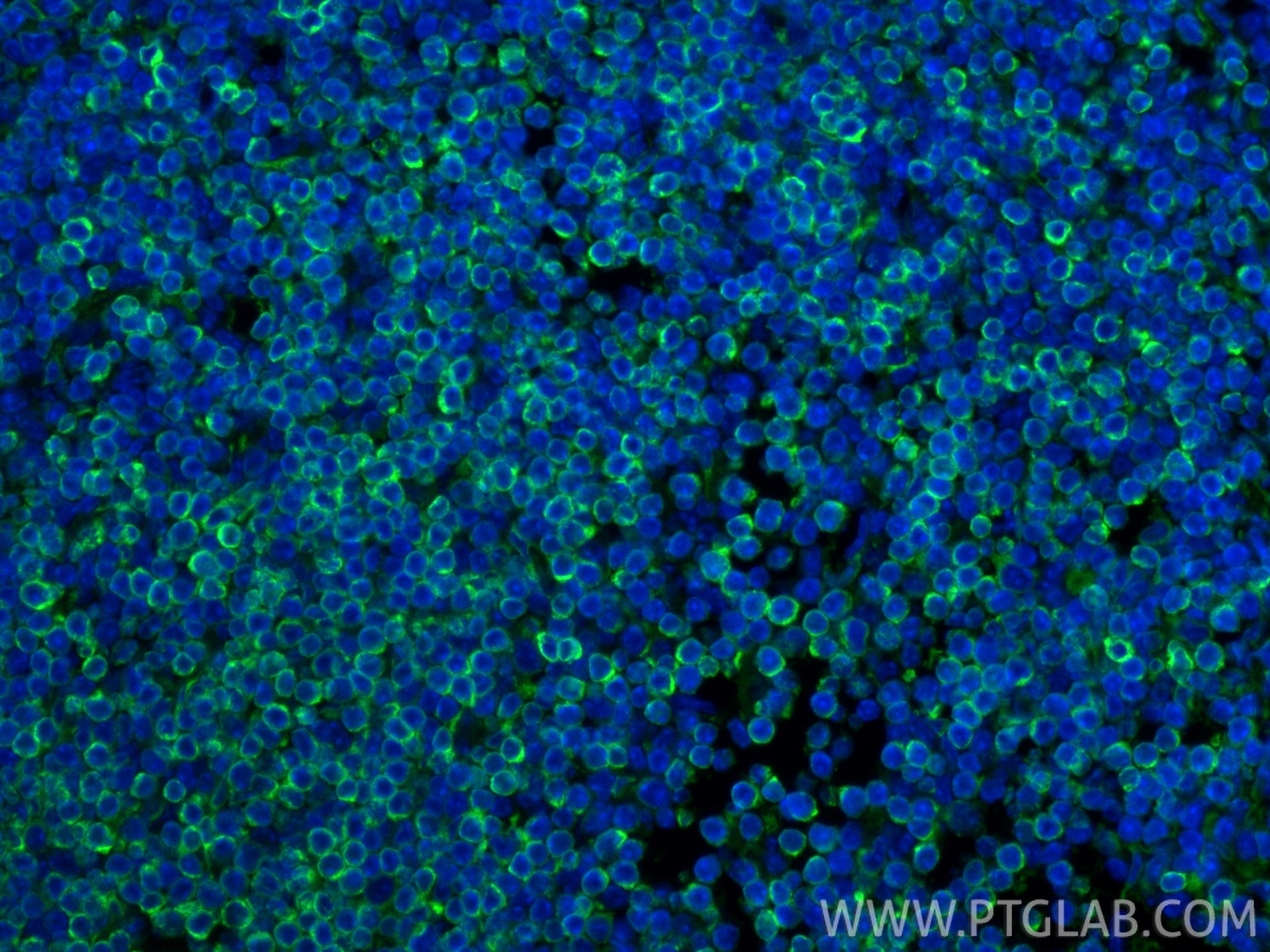 Immunofluorescent analysis of (4% PFA) fixed paraffin-embedded mouse spleen tissue using Bcl2 antibody (82469-6-RR, Clone: 240571H5 ) at dilution of 1:1000 and CoraLite®488-Conjugated Goat Anti-Rabbit IgG(H+L) (<a class='green' href='/productredirect?CatalogNo=SA00013-2' target='_blank'>SA00013-2</a>). Heat mediated antigen retrieval with Tris-EDTA buffer (pH 9.0). IF Staining of mouse spleen using 82469-6-RR