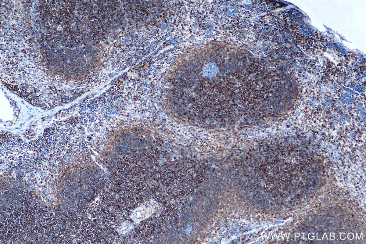 IHC staining of mouse spleen using 82469-6-RR