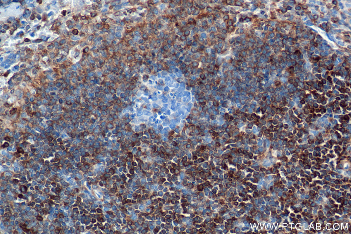 IHC staining of mouse spleen using 82469-6-RR