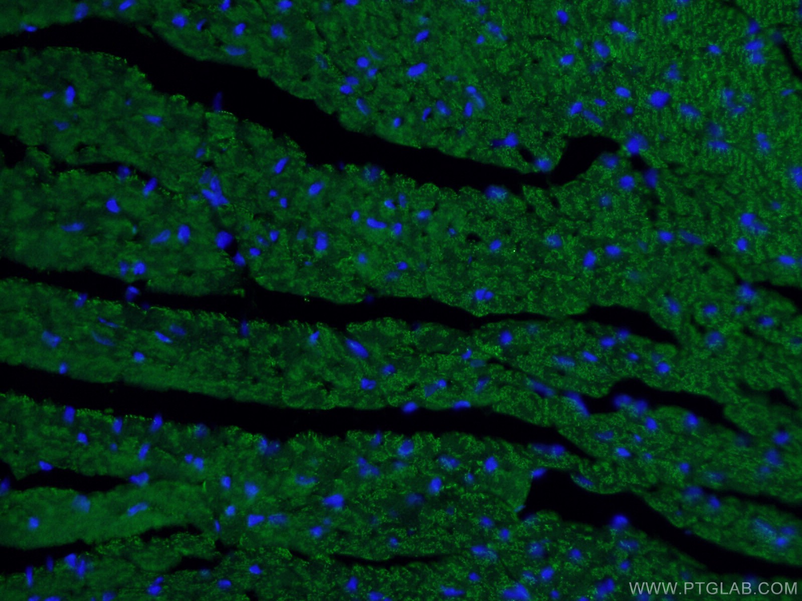 IF Staining of mouse heart using 66665-1-Ig (same clone as 66665-1-PBS)