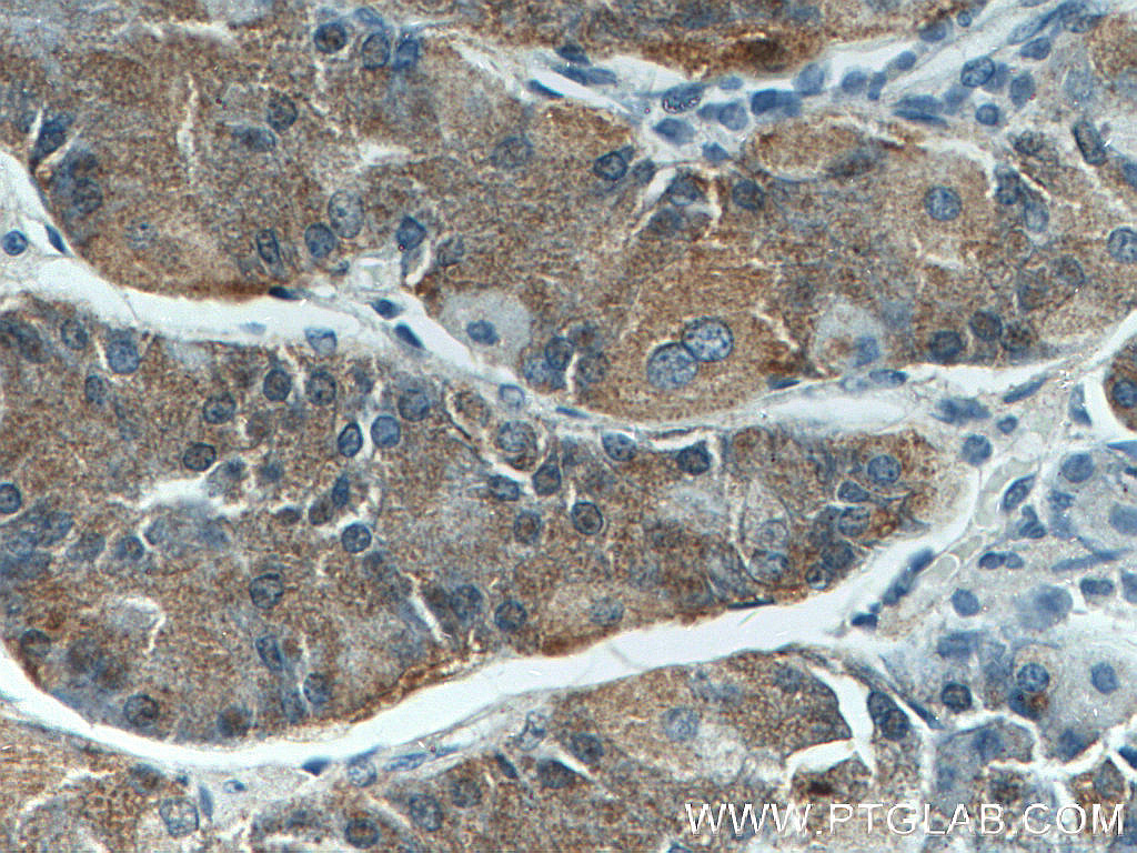 IHC staining of human stomach using 66665-1-Ig (same clone as 66665-1-PBS)
