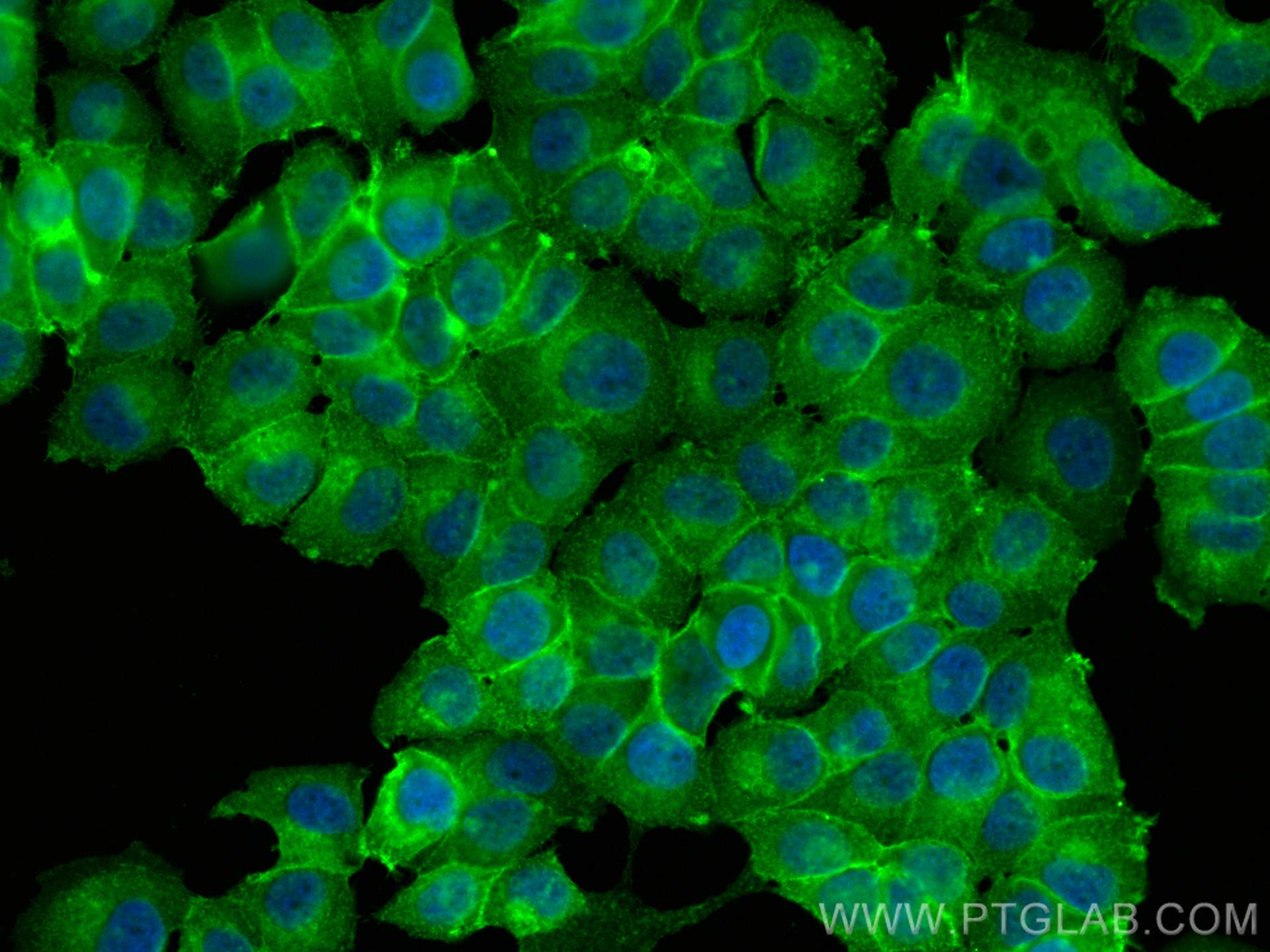 IF Staining of NCCIT using 30226-1-AP (same clone as 30226-1-PBS)