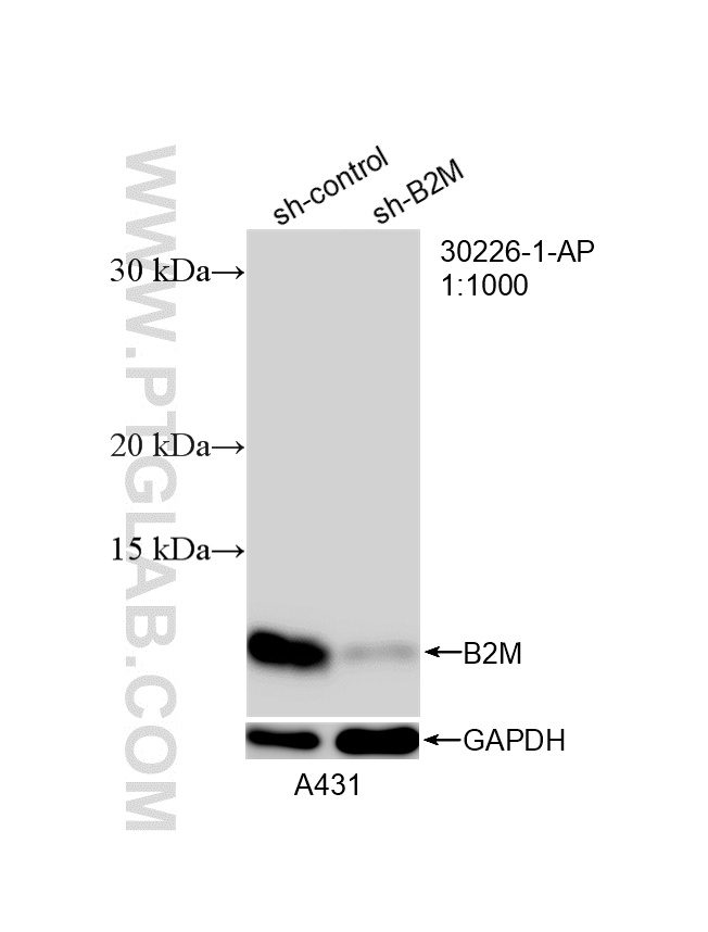 WB analysis of A431 using 30226-1-AP WB analysis of A431 using 30226-1-AP