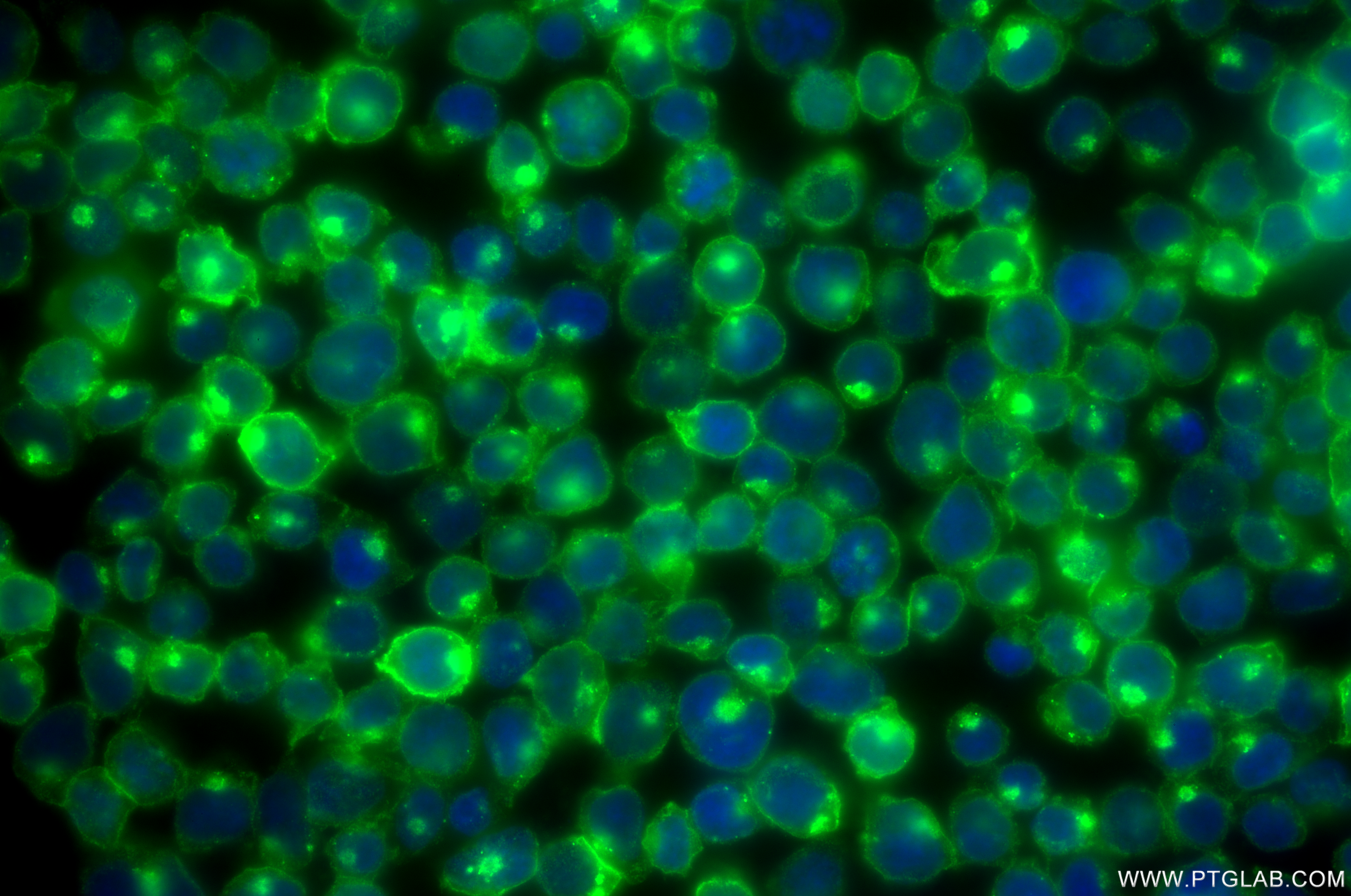 IF Staining of Jurkat using 83683-8-RR (same clone as 83683-8-PBS)