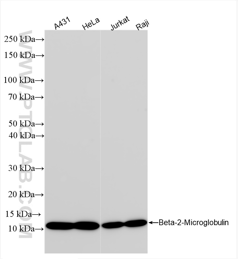 WB analysis using 83683-8-RR (same clone as 83683-8-PBS)