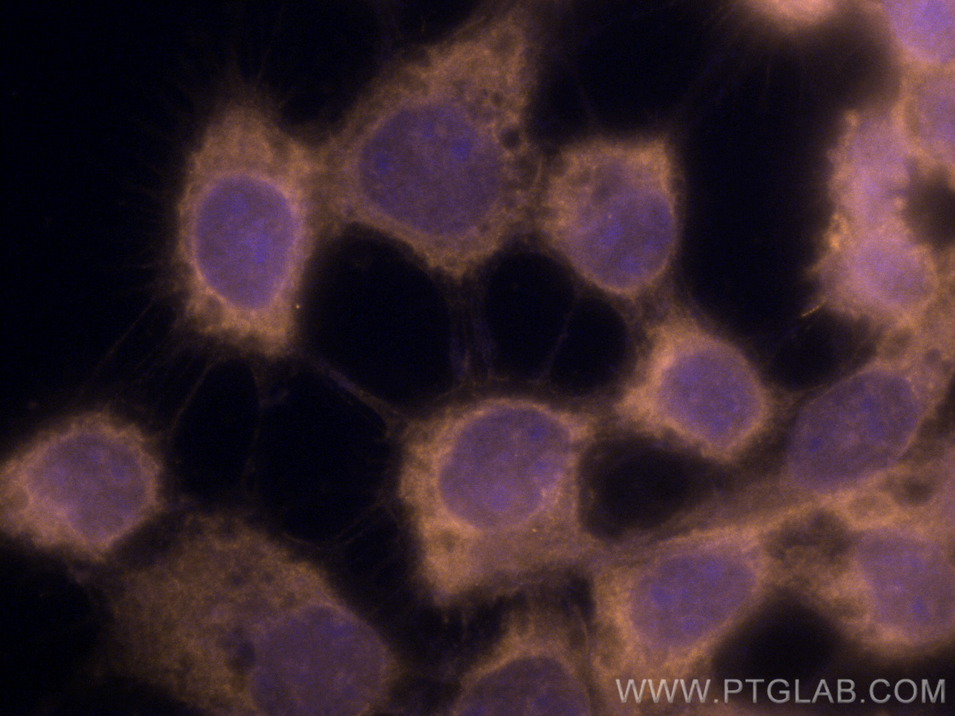 Beta-2-Microglobulin