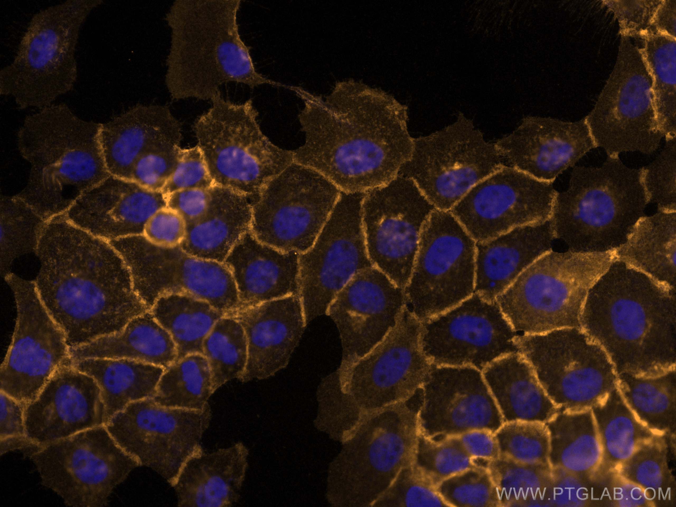 IF Staining of A431 using CL555-13511