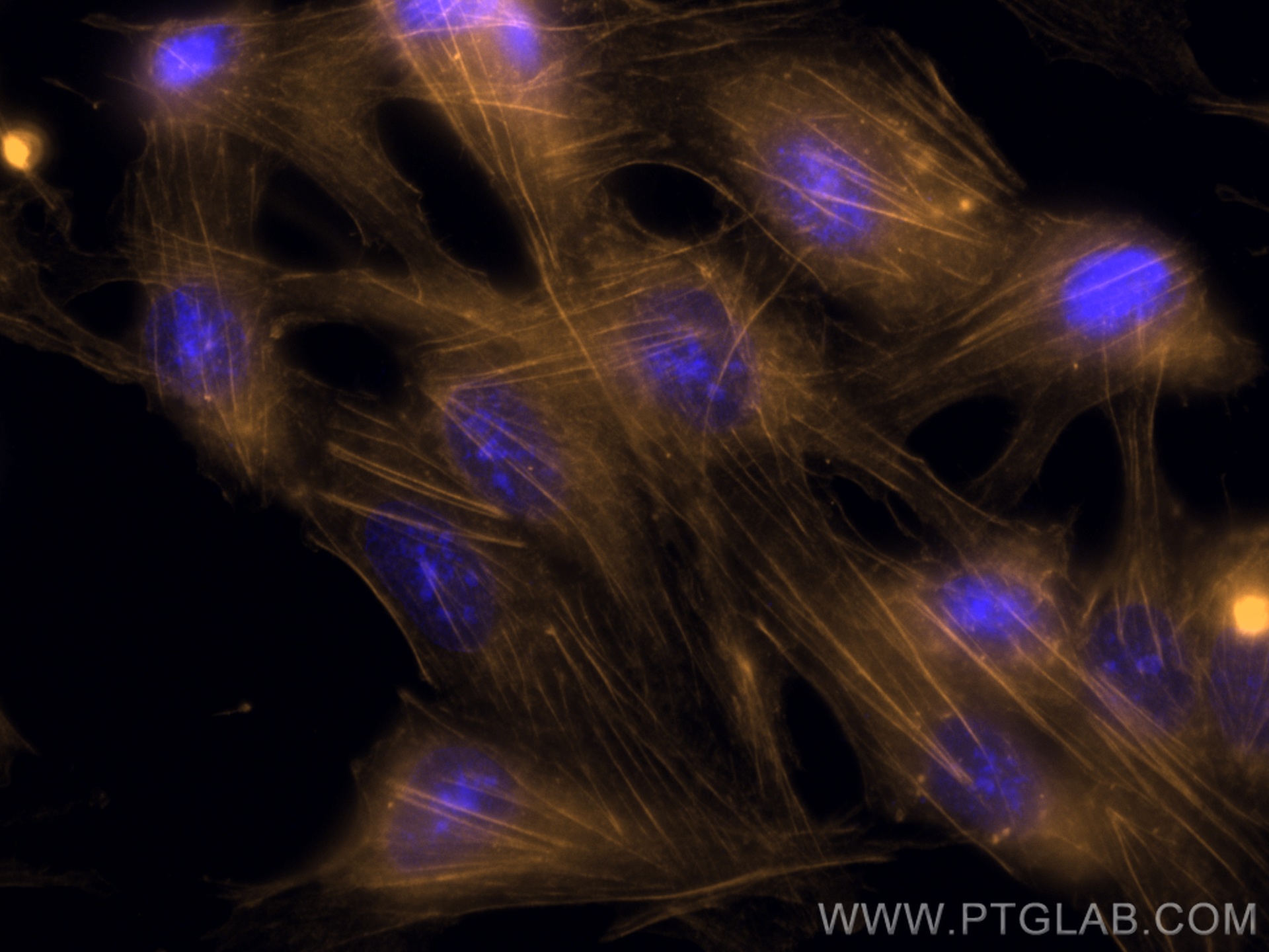 IF Staining of MDCK using CL555-81115