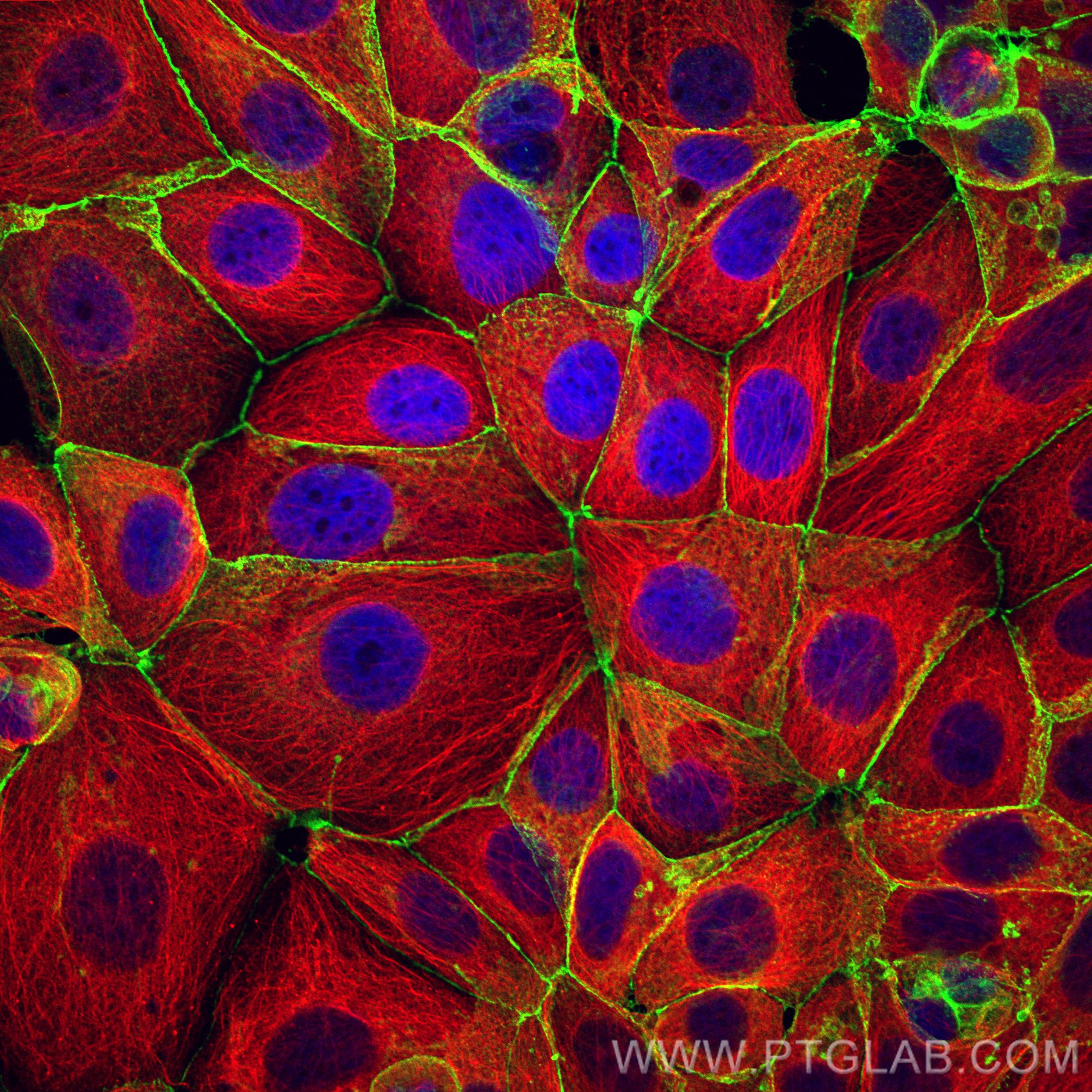 IF Staining of MCF-7 using 80488-1-RR