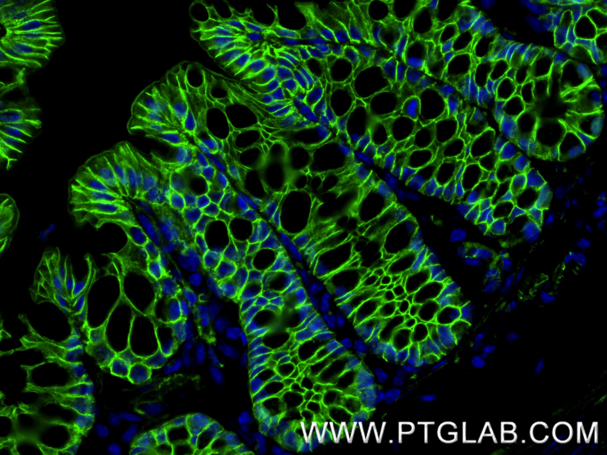 IF Staining of mouse colon using 80488-1-RR