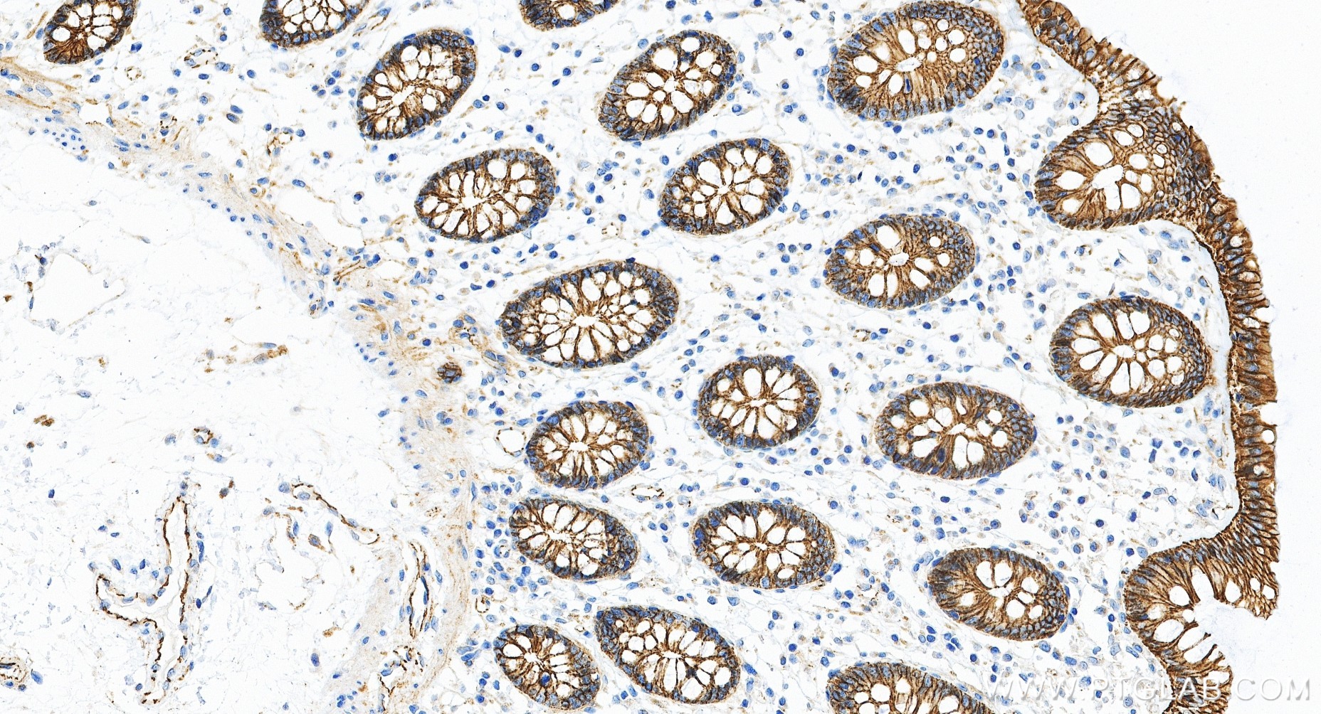 IHC staining of human colon using 80508-1-RR IHC staining of human colon using 80508-1-RR