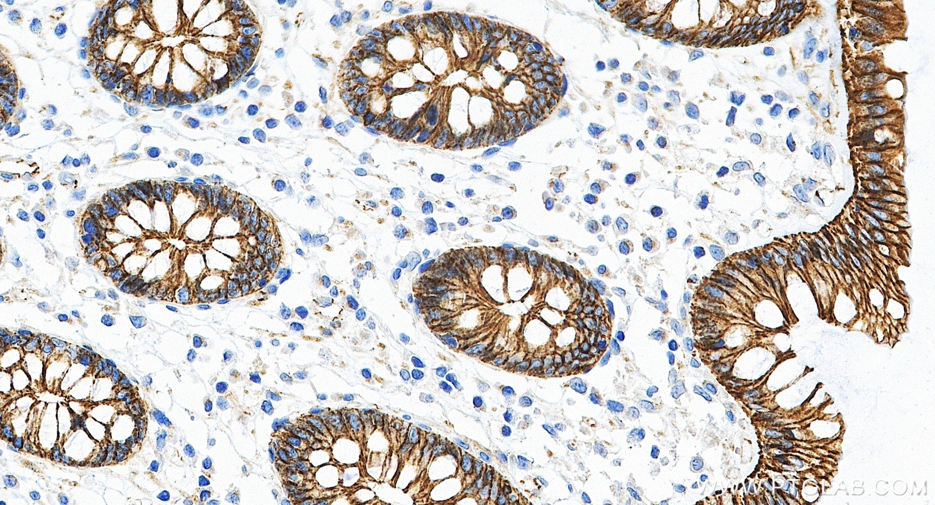 IHC staining of human colon using 80508-1-RR IHC staining of human colon using 80508-1-RR