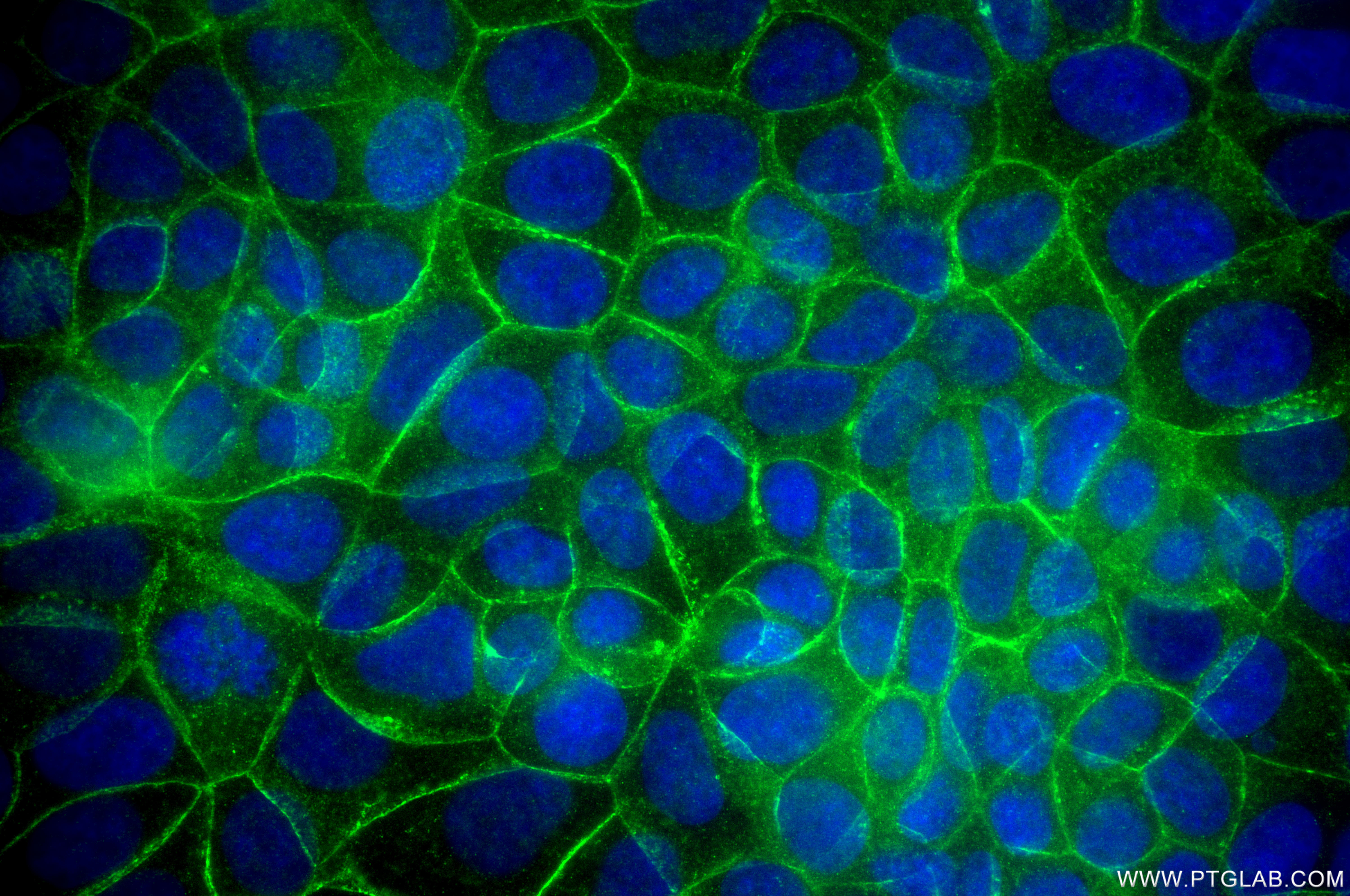 IF Staining of MCF-7 using 80508-1-RR IF Staining of MCF-7 using 80508-1-RR