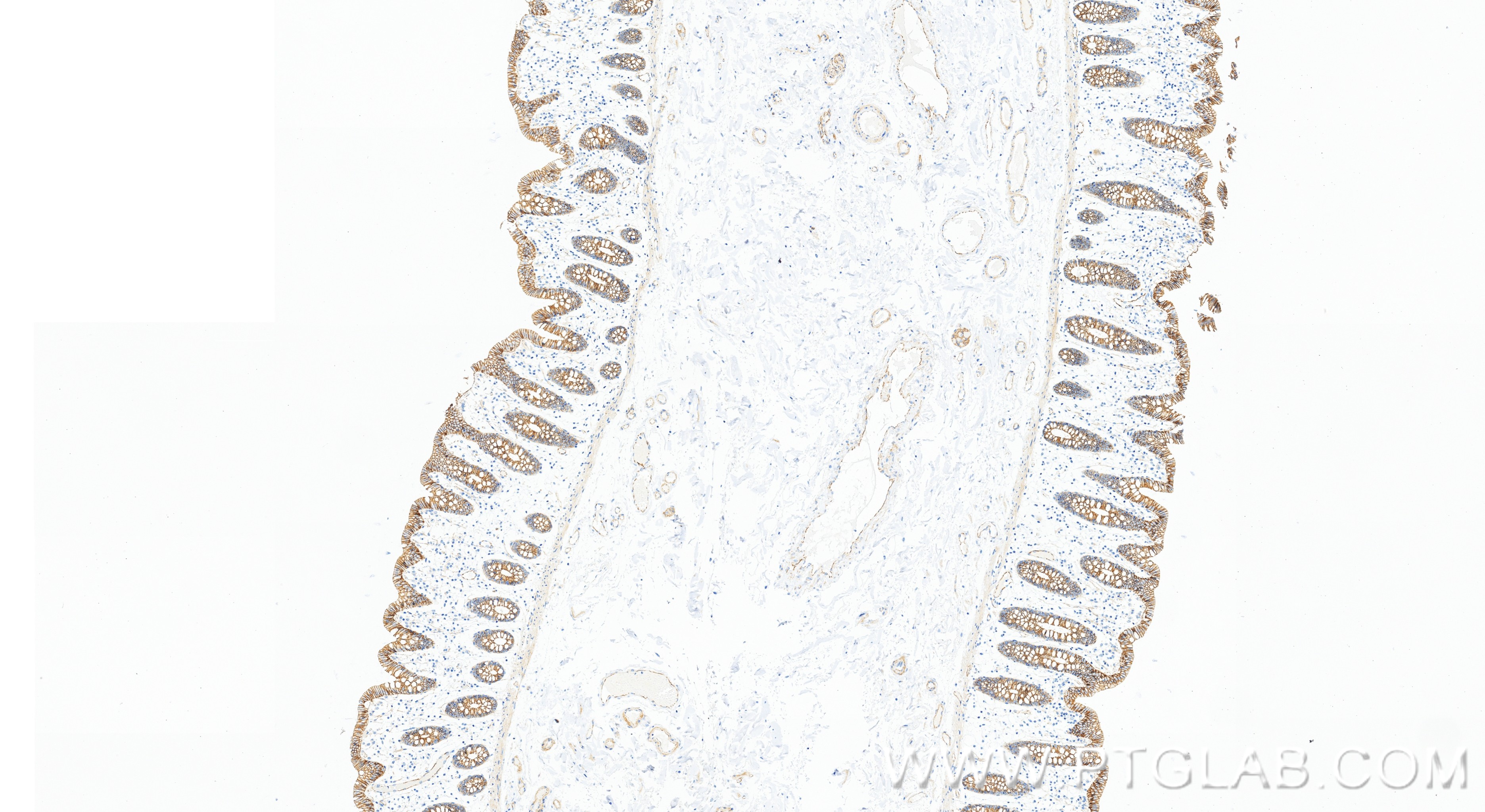 IHC staining of human colon using 98860-3-RR IHC staining of human colon using 98860-3-RR