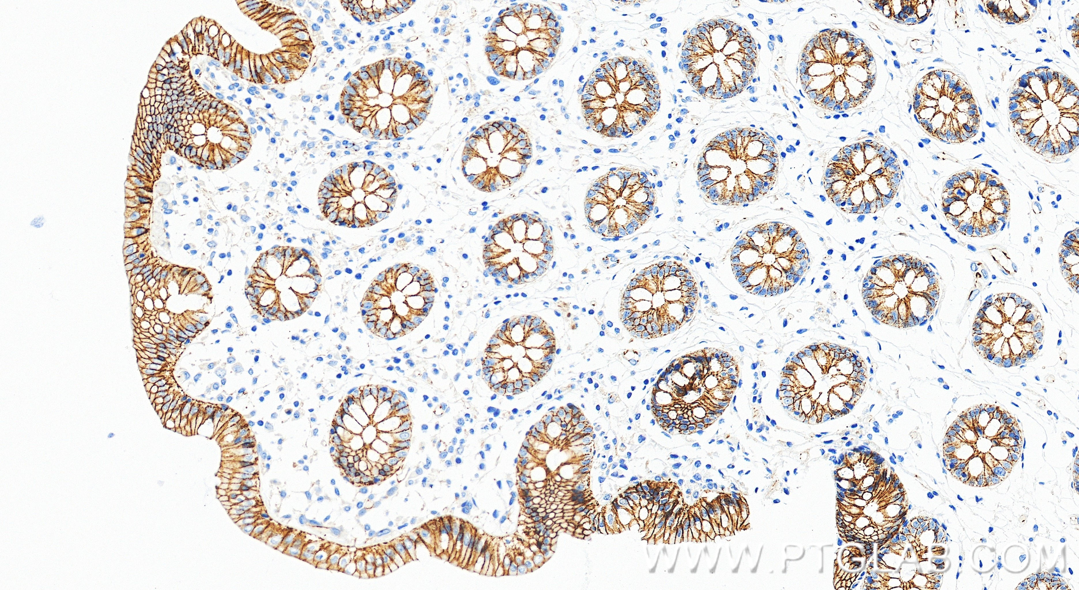 IHC staining of human colon using 98860-3-RR IHC staining of human colon using 98860-3-RR