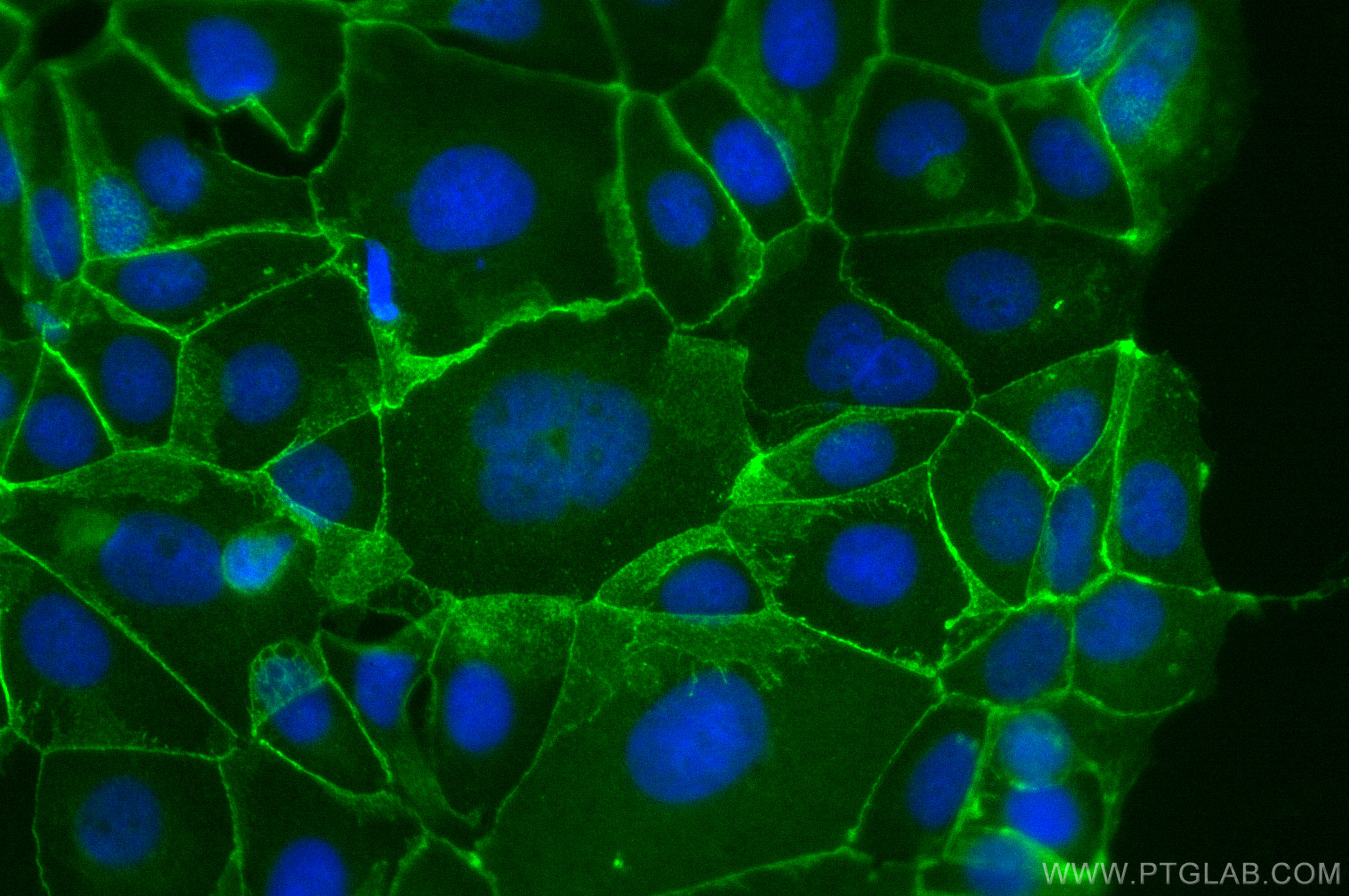 IF Staining of MCF-7 using CL488-51067